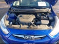 2013 Hyundai Accent — photo 10 of 20 | VIN KMHCT4AE9DU464405