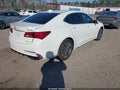 Photo 4 of 16 — 2018 Acura TLX