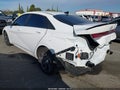 2025 Hyundai Elantra — photo 3 of 17 | VIN KMHLM4DG5SU985581