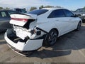 2025 Hyundai Elantra — photo 4 of 17 | VIN KMHLM4DG5SU985581