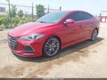 Photo 2 of 16 — 2017 Hyundai Elantra