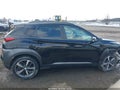 Photo 13 of 16 — 2018 Hyundai Kona