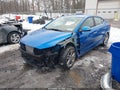 2017 Hyundai Elantra — photo 2 of 18 | VIN KMHD84LF5HU282458