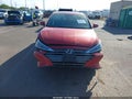 2020 Hyundai Elantra — photo 6 of 16 | VIN 5NPD84LF2LH512156