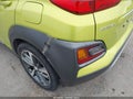 Photo 20 of 21 — 2019 Hyundai Kona
