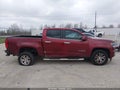 Photo 13 of 16 — 2018 Chevrolet Colorado