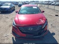 Photo 11 of 16 — 2017 Hyundai Sonata