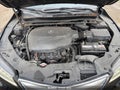 2015 Acura TLX — photo 10 of 10 | VIN 19UUB2F34FA006526