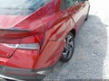2025 Hyundai Elantra — photo 6 of 16 | VIN KMHLM4DG7SU904533