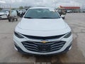 Photo 12 of 18 — 2024 Chevrolet Malibu
