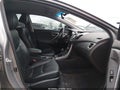 Photo 5 of 19 — 2015 Hyundai Elantra