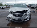 Photo 6 of 17 — 2015 Acura MDX