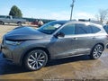 Photo 15 of 17 — 2025 Acura MDX