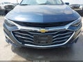 2022 Chevrolet Malibu — photo 6 of 18 | VIN 1G1ZD5ST3NF151282