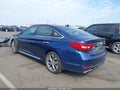 Photo 3 of 20 — 2015 Hyundai Sonata