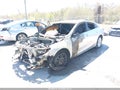 Photo 2 of 11 — 2018 Chevrolet Malibu Limited