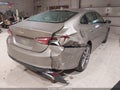 Photo 4 of 21 — 2022 Chevrolet Malibu
