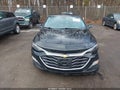 2021 Chevrolet Malibu — photo 12 of 18 | VIN 1G1ZD5ST7MF082918