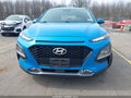 Photo 12 of 16 — 2018 Hyundai Kona