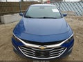 Photo 6 of 16 — 2023 Chevrolet Malibu