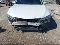 Photo 6 of 18 — 2015 Acura TLX