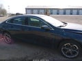 Photo 13 of 16 — 2021 Chevrolet Malibu