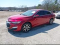 Photo 2 of 17 — 2024 Chevrolet Malibu