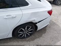 Photo 20 of 20 — 2017 Chevrolet Malibu