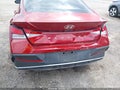 Photo 6 of 16 — 2024 Hyundai Elantra