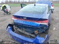 Photo 6 of 17 — 2022 Hyundai Elantra