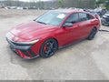 Photo 2 of 17 — 2025 Hyundai Elantra