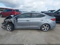 Photo 13 of 17 — 2017 Hyundai Elantra