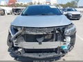 Photo 13 of 17 — 2018 Chevrolet Malibu Limited