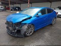 Photo 2 of 16 — 2017 Hyundai Elantra