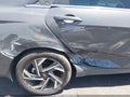 Photo 6 of 16 — 2024 Hyundai Elantra