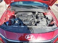 Photo 10 of 16 — 2025 Hyundai Elantra