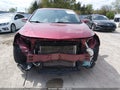 Photo 13 of 20 — 2018 Chevrolet Malibu Limited
