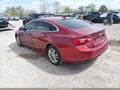 Photo 3 of 20 — 2018 Chevrolet Malibu Limited
