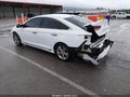 Photo 3 of 17 — 2018 Hyundai Sonata