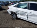 Photo 6 of 16 — 2024 Hyundai Elantra