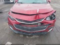 Photo 6 of 16 — 2018 Chevrolet Malibu Limited