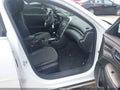 Photo 5 of 11 — 2016 Chevrolet Malibu Limited