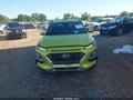 Photo 13 of 17 — 2019 Hyundai Kona