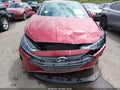 Photo 6 of 16 — 2020 Hyundai Elantra