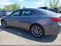 Photo 14 of 16 — 2017 Acura TLX