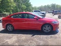Photo 13 of 16 — 2018 Hyundai Elantra