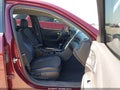Photo 5 of 17 — 2016 Chevrolet Malibu Limited
