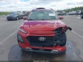 Photo 12 of 16 — 2018 Hyundai Kona