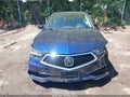 2018 Acura TLX — photo 12 of 16 | VIN 19UUB2F54JA003572