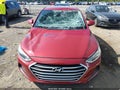 Photo 6 of 17 — 2018 Hyundai Elantra